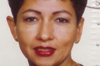 Abstehende Ohren vor OP - Bild 5